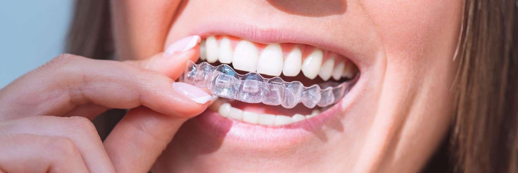 A smiling lady with Invisalign in Burnaby, BC