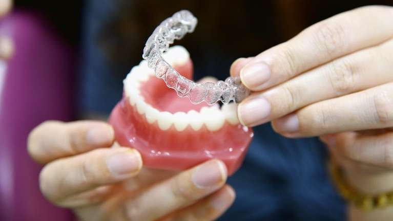 Invisalign in Burnaby bc